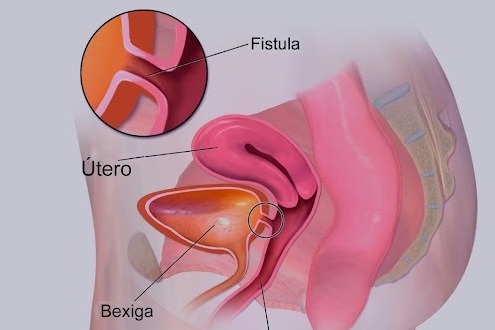 Urologia Geral